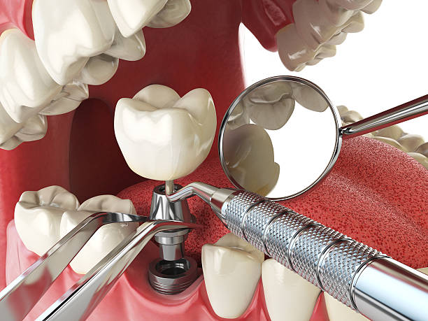 Best Emergency Care for Gum Disease in Aspermont, TX