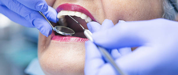 Best Emergency Treatment for Oral Infections in Aspermont, TX